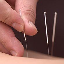 Akupunktura: zdravstvene koristi in škoda